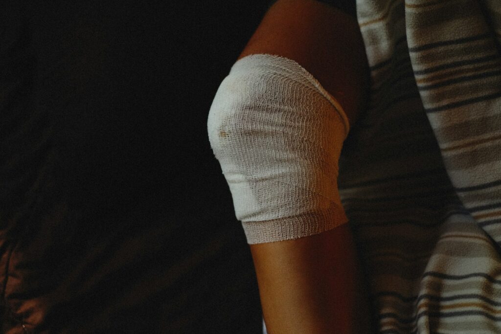 Knee Swelling