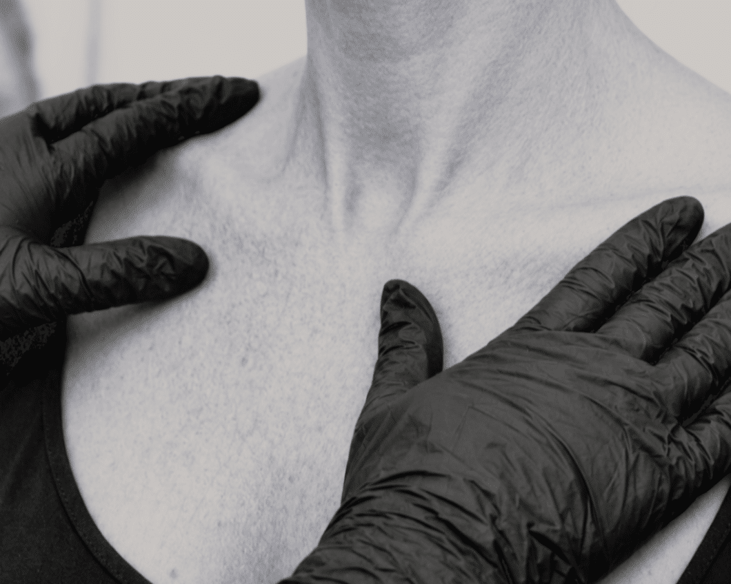 Neck and decolletage area